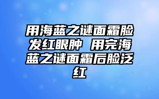 用海藍(lán)之謎面霜臉發(fā)紅眼腫 用完海藍(lán)之謎面霜后臉?lè)杭t