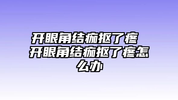 開(kāi)眼角結(jié)痂摳了疼 開(kāi)眼角結(jié)痂摳了疼怎么辦